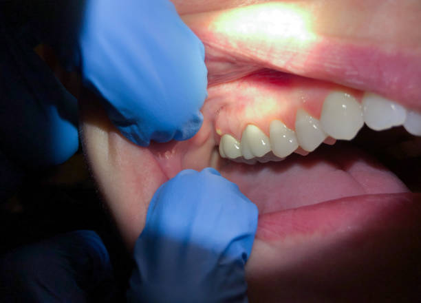 Best Tooth Pain Emergency Relief  in Round Lake, IL